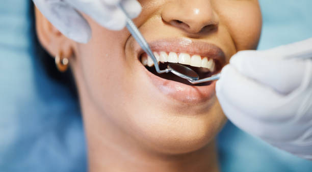 Best Emergency Tooth Extraction in Catawba, SC