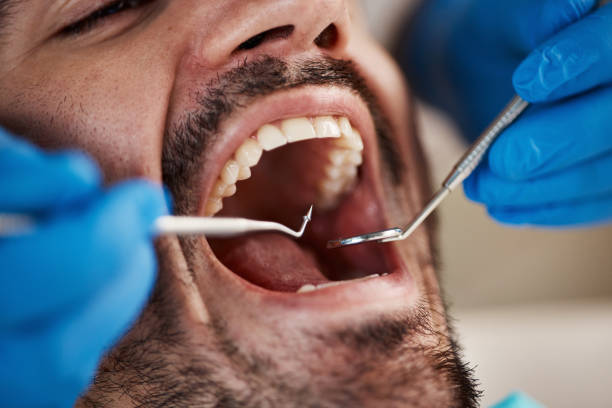 Best Pediatric Emergency Dentist in Catawba, SC